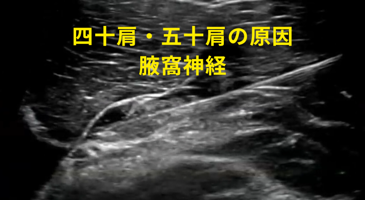 刈谷・安城・知立・東浦・大府で評判の刈谷はりきゅうマッサージ院はエコーを用いて、四十肩・五十肩の原因となる神経や筋膜に対して鍼灸・神経施術を行う