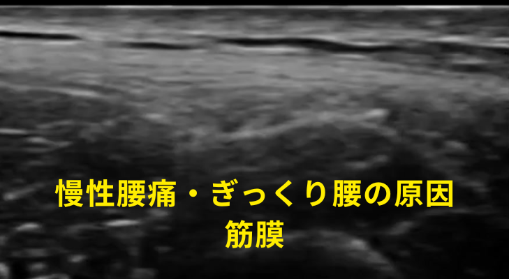 刈谷・安城・知立・東浦・大府で評判の刈谷はりきゅうマッサージ院はエコーを用いて、慢性腰痛・ぎっくり腰の原因となる神経や筋膜に対して鍼灸・神経施術を行う
